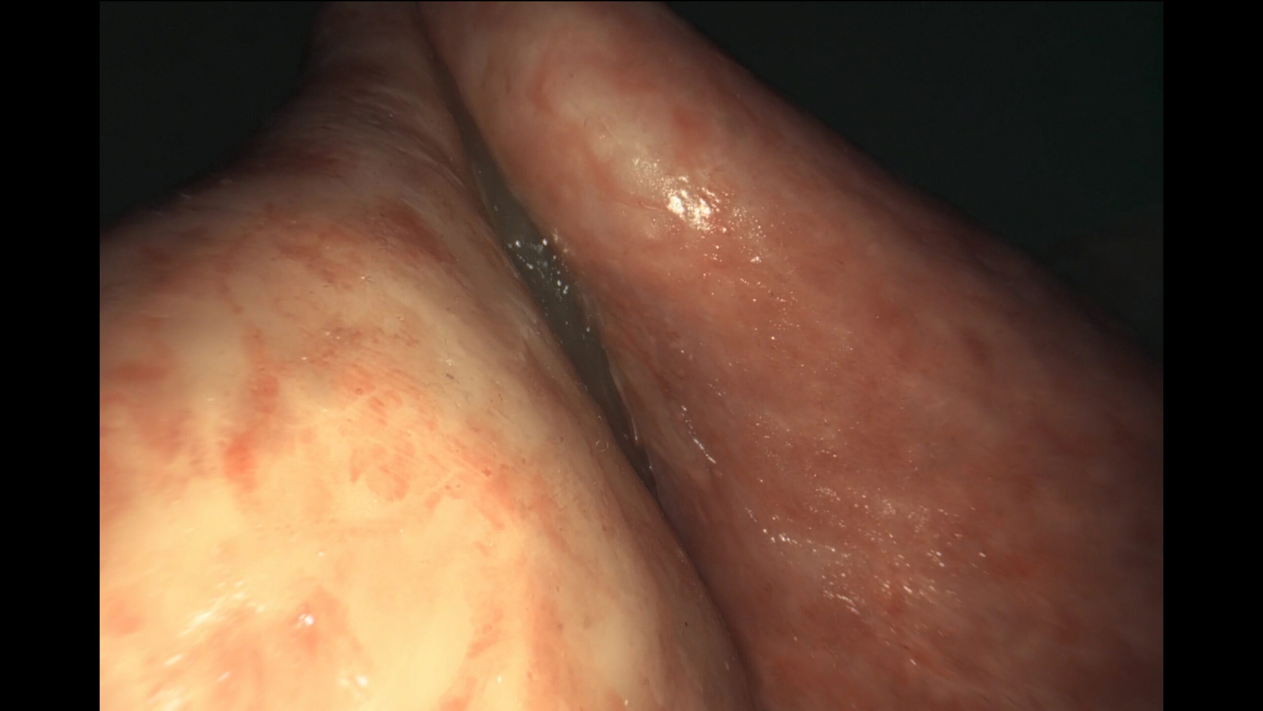 SaftStill2 - Philip Varkki