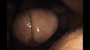 SaftStill5 - Philip Varkki